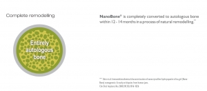 Nanobone (Large) Granulate 24% Silica / 76% Hydroxylapatite
